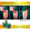Dead Sea Minerals Anti Psoriasis Set – Psor Soap + Pso Skin Relief Cream with Dead Sea Minerals, 2 Pack